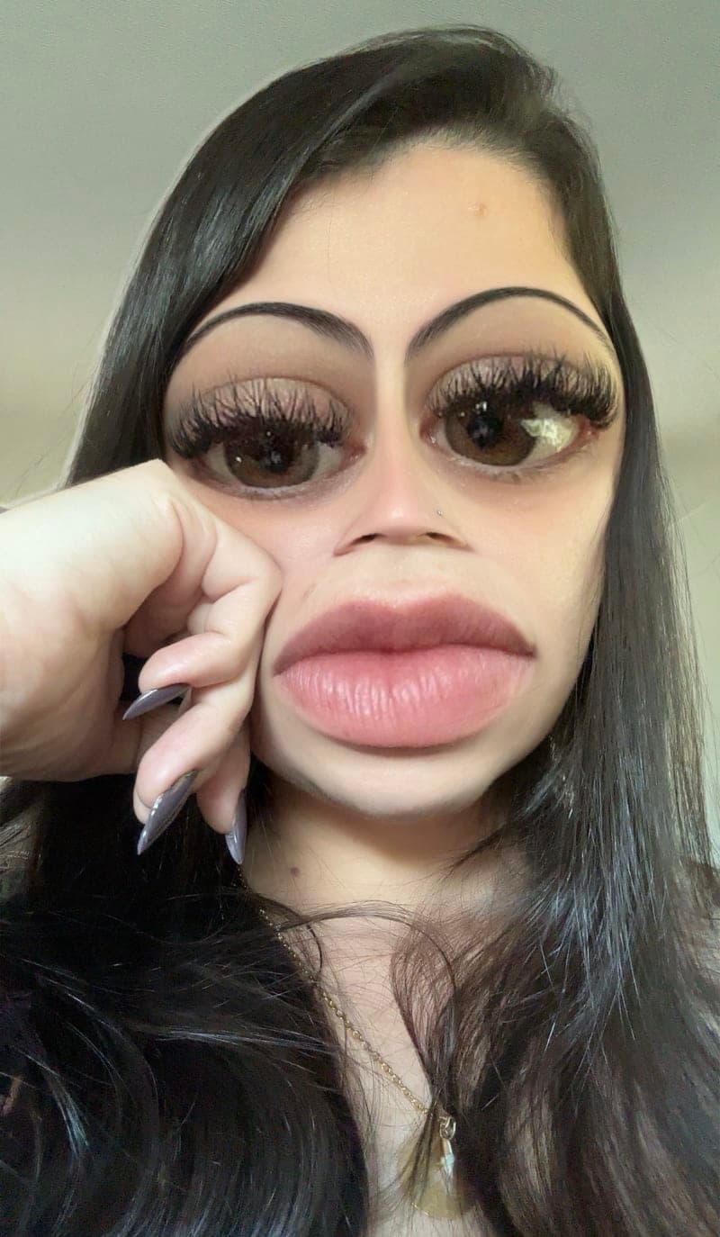 alineavelar2
